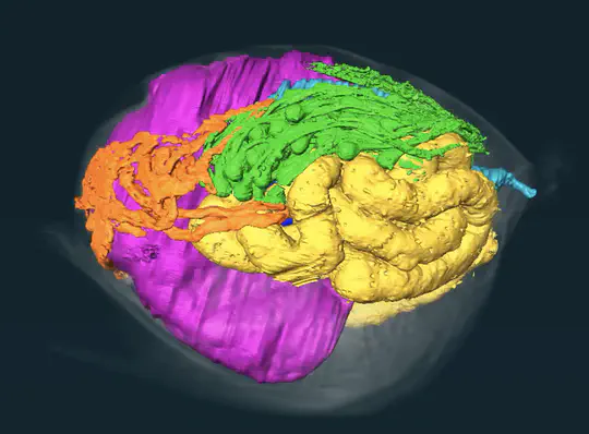 (2020-2022) Anatomie comparée des glandes à venin des Cynipidae